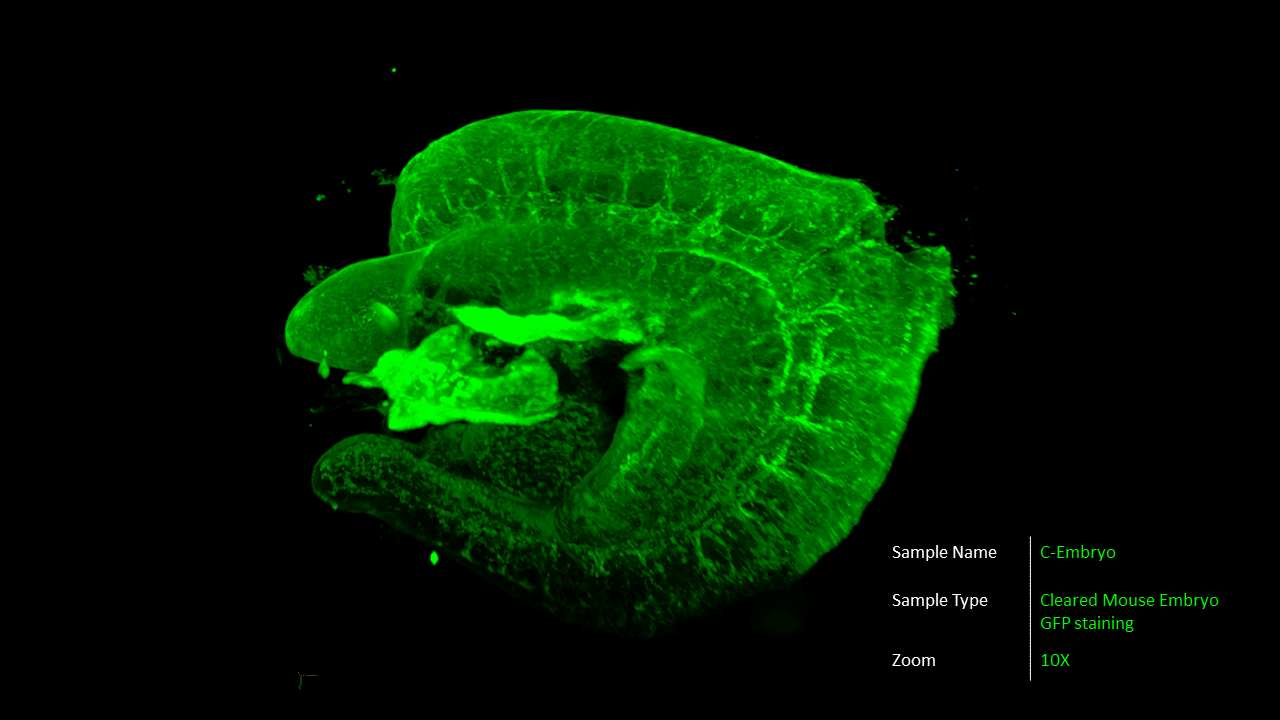 ALPHA 3 Light Sheet Fluorescence Microscope for fast and accurate 3D