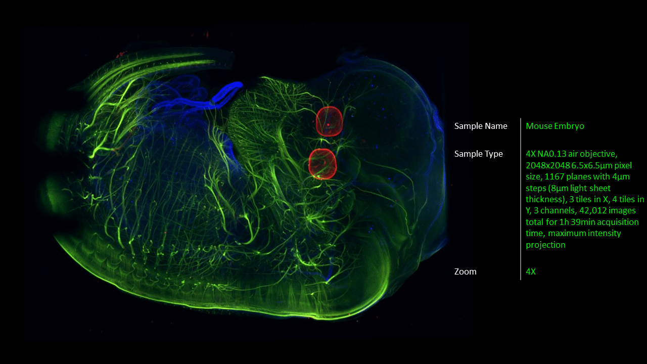 ALPHA 3 Light Sheet Fluorescence Microscope for fast and accurate 3D