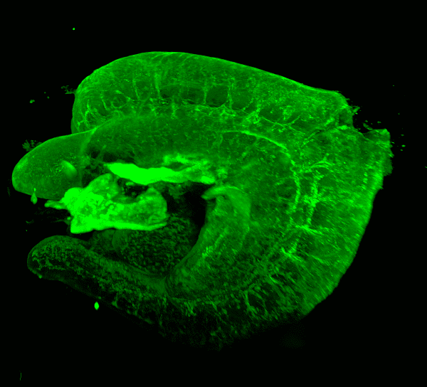 ALPHA 3 Light Sheet Fluorescence Microscope for fast and accurate 3D