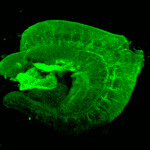 Rescan Confocal Microscope