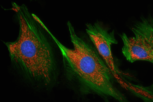 fluorescence microscopy