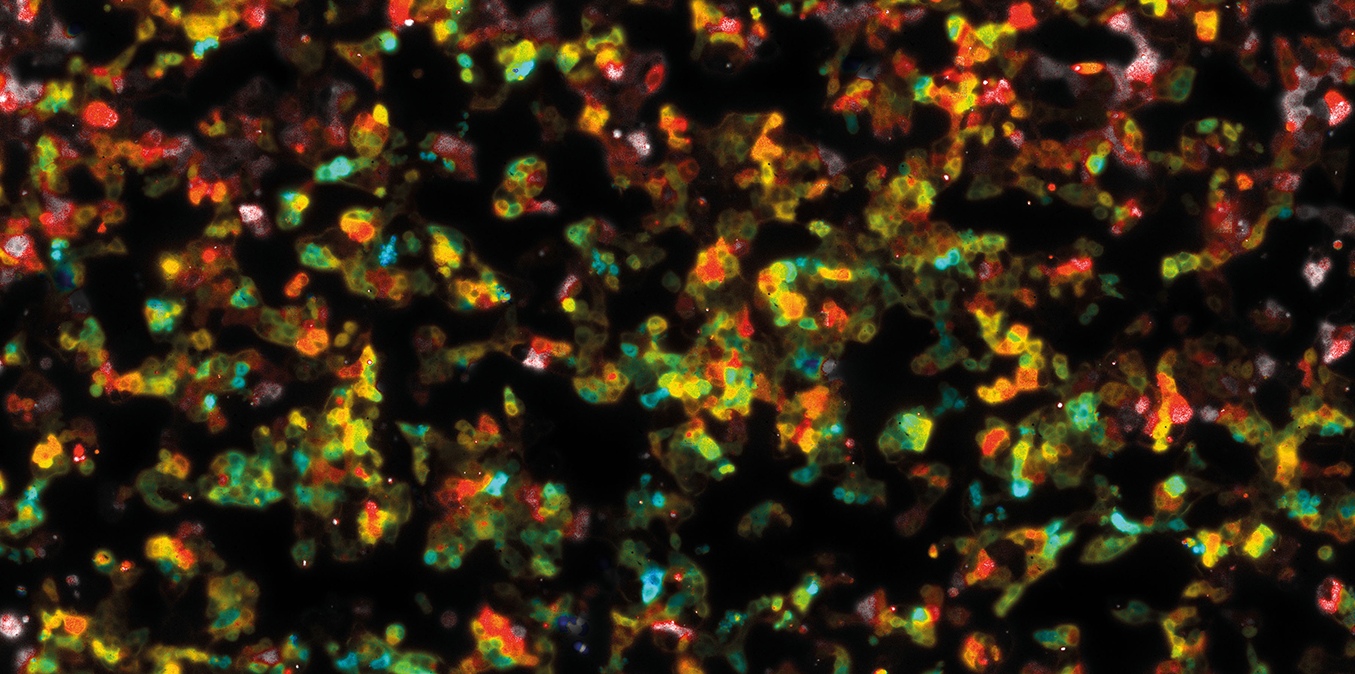 Stitched lifetime image of Hap 1 cells expressing EPAC-sensor that shows a lifetime increase when cAMP concentration increases after stimulation with isoproternol