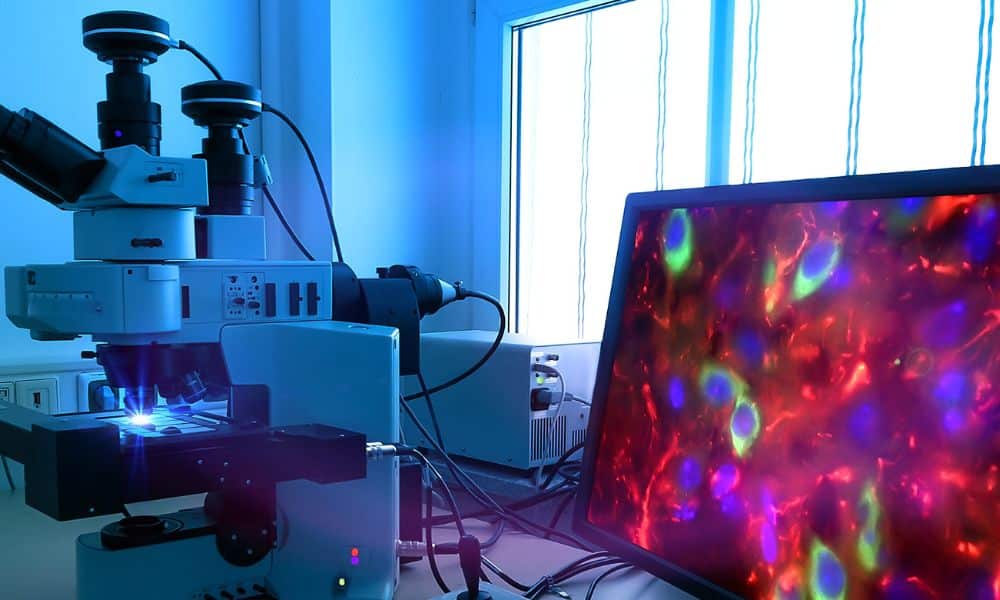 3 Advantages of Re-Scan Confocal Microscopy
